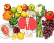 برای دفع سنگ حالب چه بخوریم؟