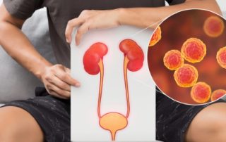 علائم عفونت کلیه چیست؟