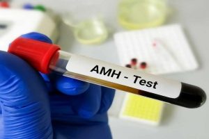 آزمایش AMH چیست ؟