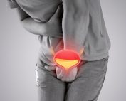 آیا سرطان مثانه ارثی است؟