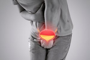 آیا سرطان مثانه ارثی است؟