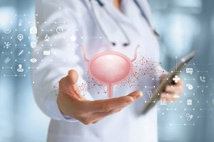 آیا سرطان مثانه بدون علامت است؟
