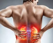 آیا سنگ کلیه باعث سنگ حالب می‌شود؟
