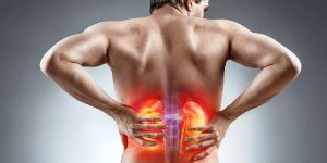 آیا سنگ کلیه باعث سنگ حالب می‌شود؟