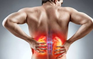 آیا سنگ کلیه باعث سنگ حالب می‌شود؟