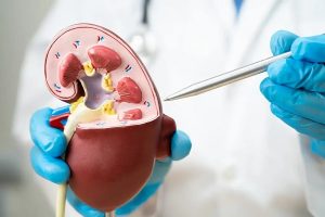 آیا می‌توان با یک کلیه زندگی کرد؟