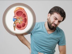 بهترین روش تشخیص سنگ حالب چیست؟