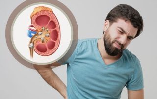 بهترین روش تشخیص سنگ حالب چیست؟