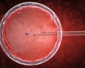 IVF چیست؟