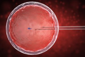 IVF چیست؟