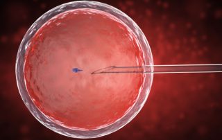 IVF چیست؟