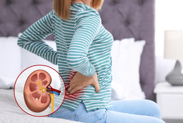 برای درد کلیه به چه دکتری مراجعه کنیم؟
