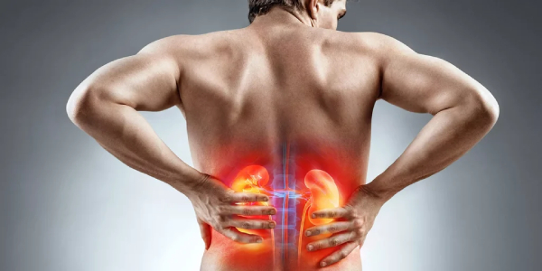 تفاوت سنگ کلیه و عفونت کلیه
