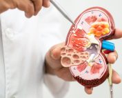 سنگ کلیه چگونه تشکیل می‌شود؟